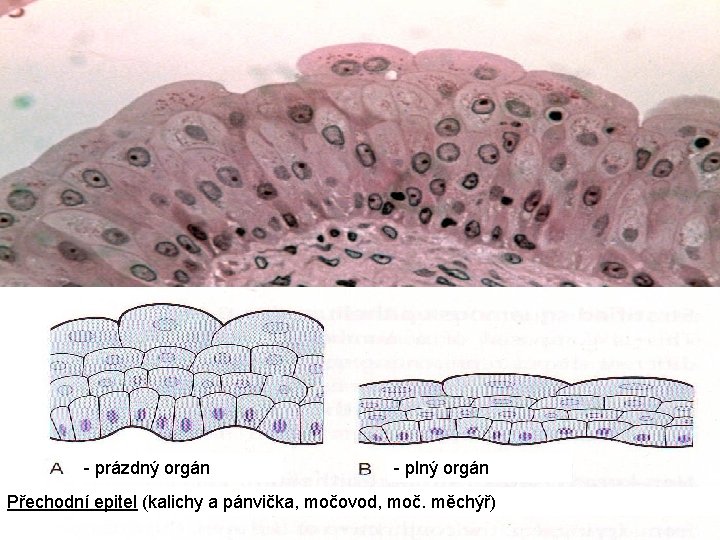 - prázdný orgán - plný orgán Přechodní epitel (kalichy a pánvička, močovod, moč. měchýř)