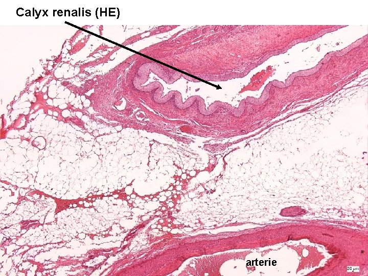 Calyx renalis (HE) arterie 