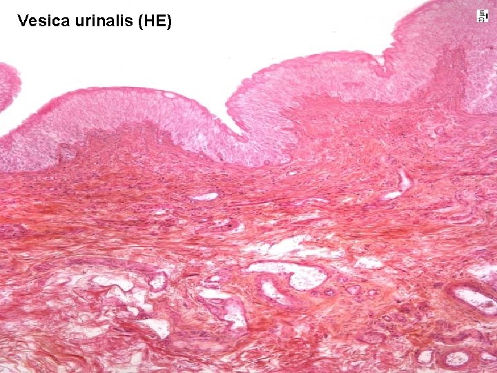 Vesica urinalis (HE) 