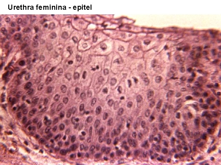 Urethra feminina - epitel 