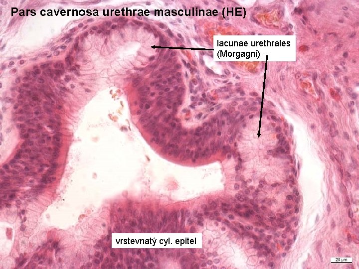 Pars cavernosa urethrae masculinae (HE) lacunae urethrales (Morgagni) vrstevnatý cyl. epitel 