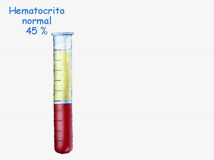 Hematocrito normal 45 % 