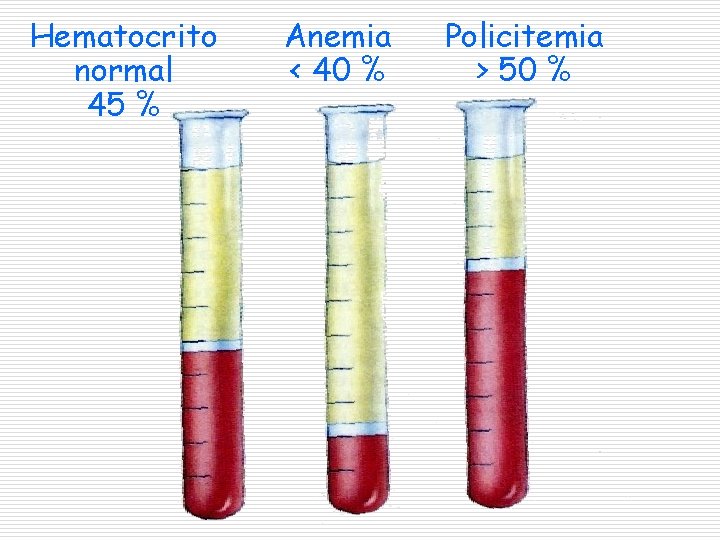 Hematocrito normal 45 % Anemia < 40 % Policitemia > 50 % 