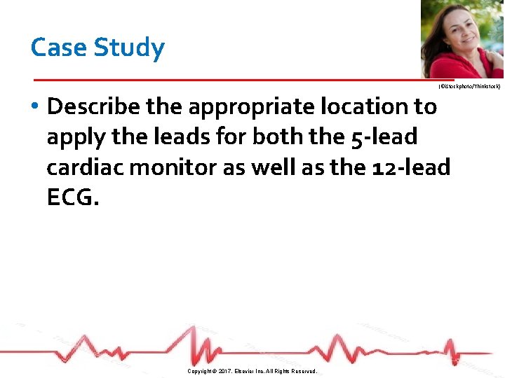 Case Study (©i. Stockphoto/Thinkstock) • Describe the appropriate location to apply the leads for