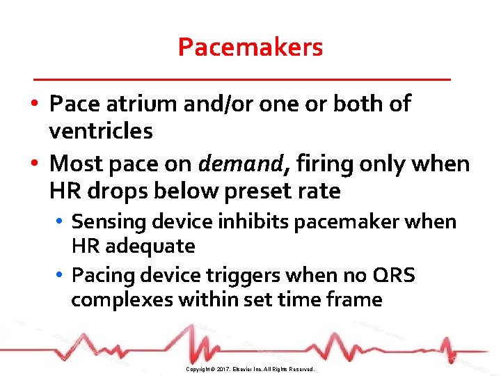 Pacemakers • Pace atrium and/or one or both of ventricles • Most pace on
