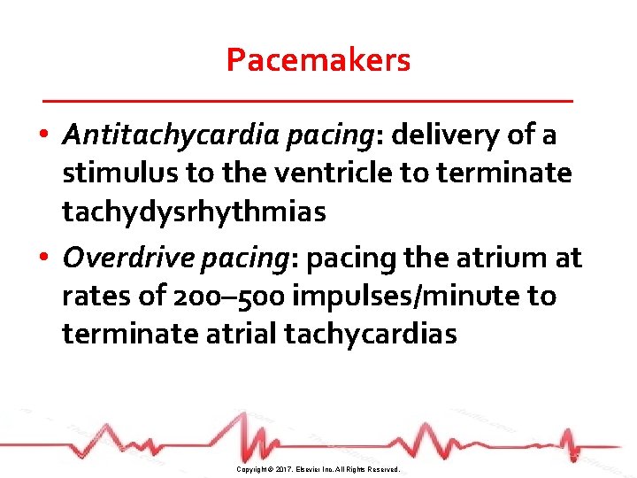 Pacemakers • Antitachycardia pacing: delivery of a stimulus to the ventricle to terminate tachydysrhythmias