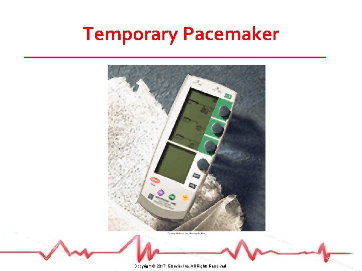 Temporary Pacemaker Copyright © 2017, Elsevier Inc. All Rights Reserved. 