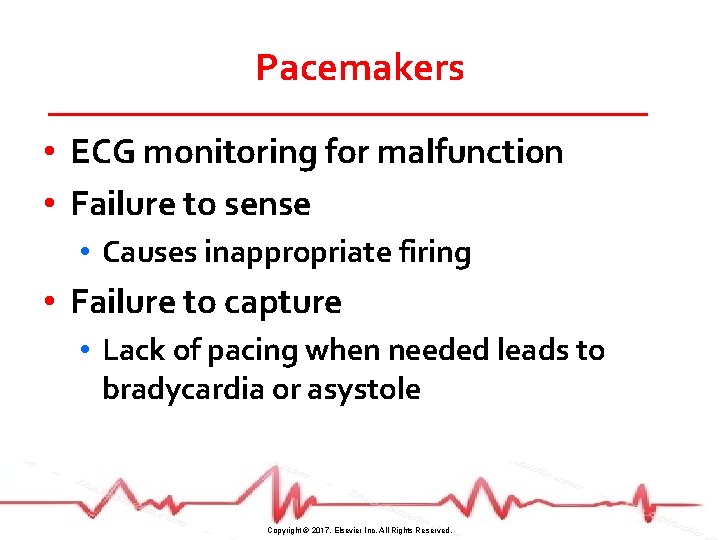 Pacemakers • ECG monitoring for malfunction • Failure to sense • Causes inappropriate firing