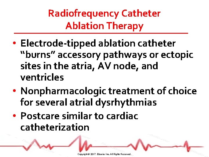 Radiofrequency Catheter Ablation Therapy • Electrode-tipped ablation catheter “burns” accessory pathways or ectopic sites