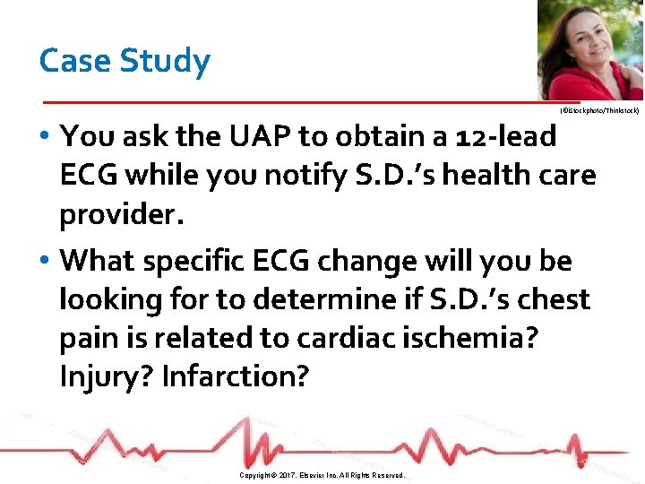 Case Study (©i. Stockphoto/Thinkstock) • You ask the UAP to obtain a 12 -lead
