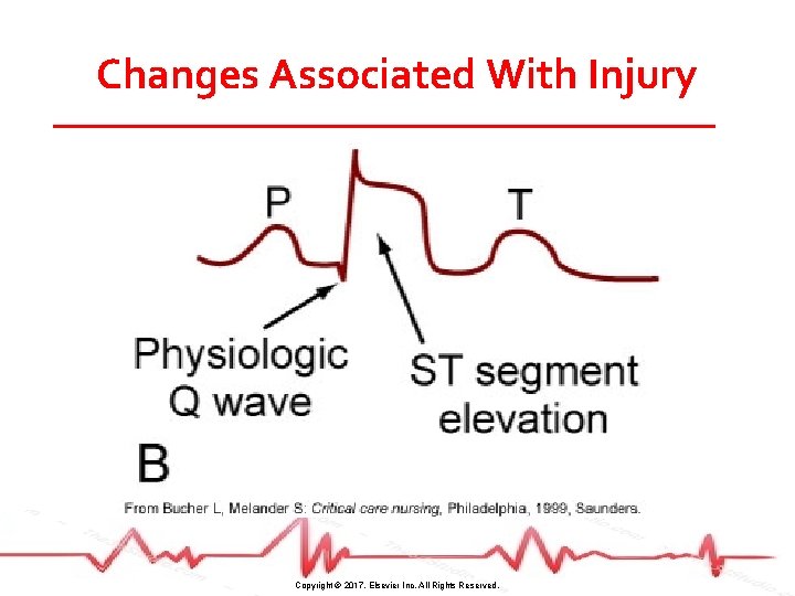 Changes Associated With Injury Copyright © 2017, Elsevier Inc. All Rights Reserved. 