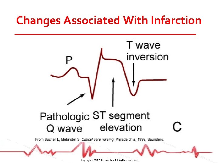 Changes Associated With Infarction Copyright © 2017, Elsevier Inc. All Rights Reserved. 