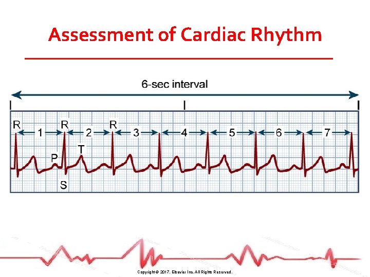 Assessment of Cardiac Rhythm Copyright © 2017, Elsevier Inc. All Rights Reserved. 
