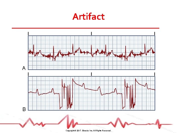 Artifact Copyright © 2017, Elsevier Inc. All Rights Reserved. 