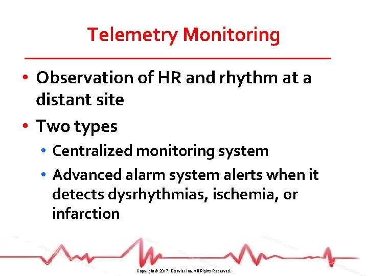 Telemetry Monitoring • Observation of HR and rhythm at a distant site • Two