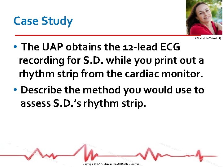 Case Study (©i. Stockphoto/Thinkstock) • The UAP obtains the 12 -lead ECG recording for