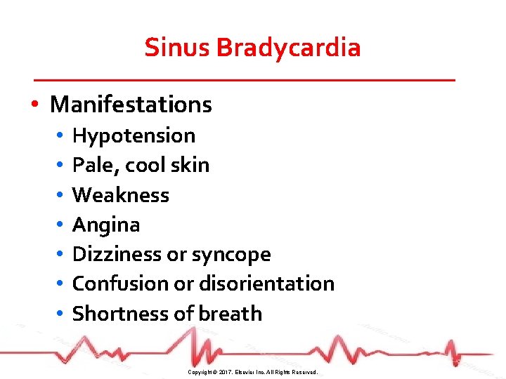 Sinus Bradycardia • Manifestations • • Hypotension Pale, cool skin Weakness Angina Dizziness or
