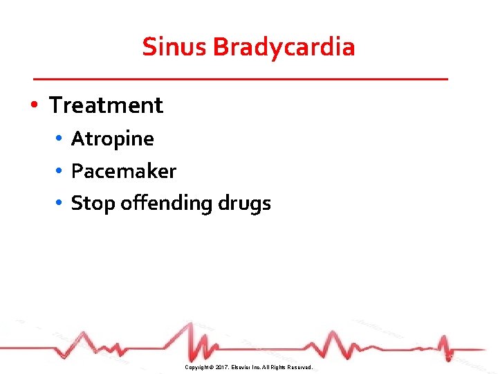 Sinus Bradycardia • Treatment • Atropine • Pacemaker • Stop offending drugs Copyright ©