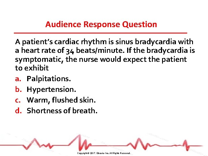 Audience Response Question A patient’s cardiac rhythm is sinus bradycardia with a heart rate