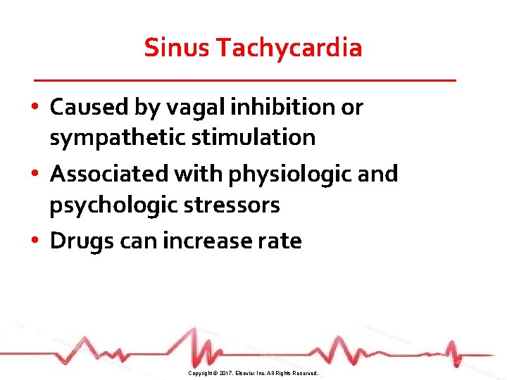 Sinus Tachycardia • Caused by vagal inhibition or sympathetic stimulation • Associated with physiologic
