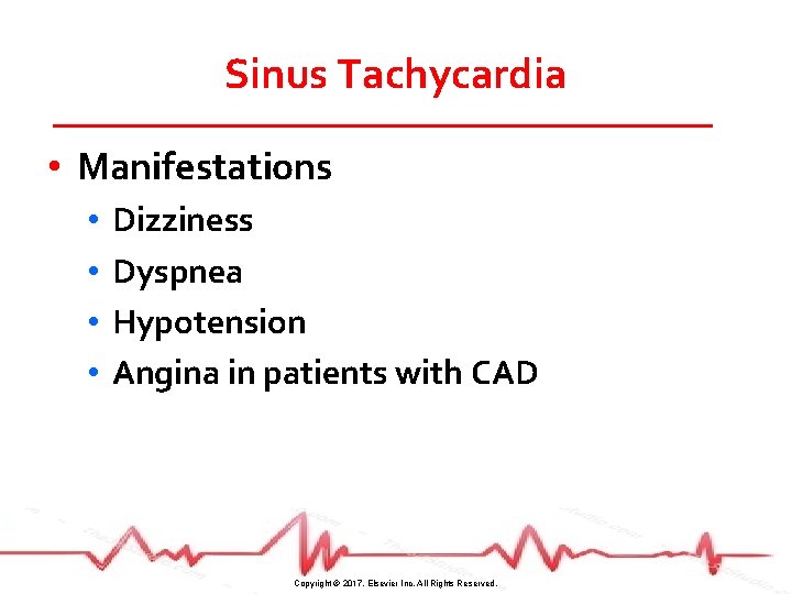 Sinus Tachycardia • Manifestations • • Dizziness Dyspnea Hypotension Angina in patients with CAD
