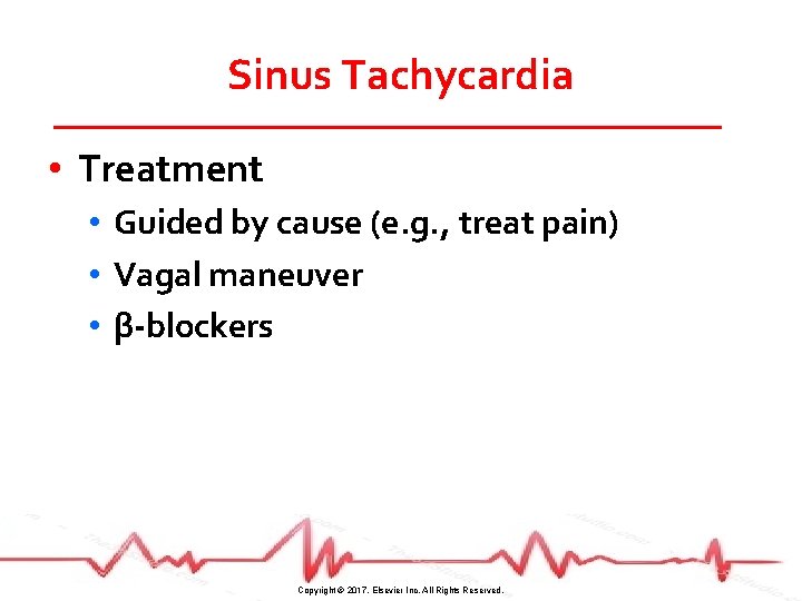 Sinus Tachycardia • Treatment • Guided by cause (e. g. , treat pain) •