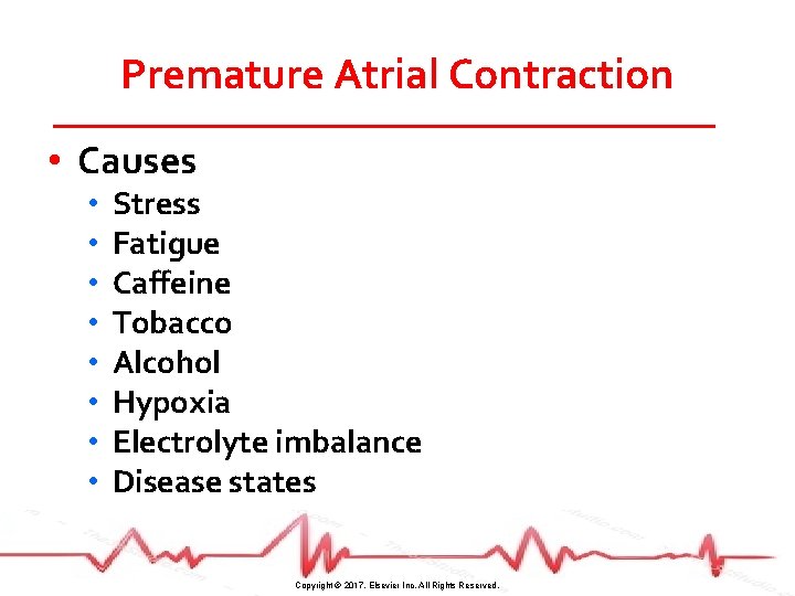 Premature Atrial Contraction • Causes • • Stress Fatigue Caffeine Tobacco Alcohol Hypoxia Electrolyte