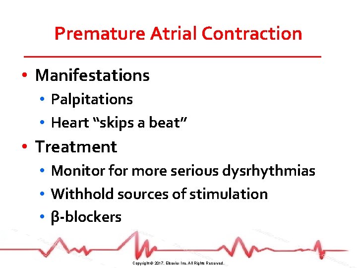 Premature Atrial Contraction • Manifestations • Palpitations • Heart “skips a beat” • Treatment