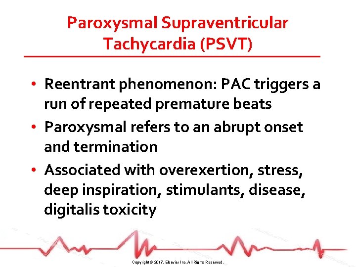 Paroxysmal Supraventricular Tachycardia (PSVT) • Reentrant phenomenon: PAC triggers a run of repeated premature