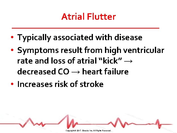 Atrial Flutter • Typically associated with disease • Symptoms result from high ventricular rate