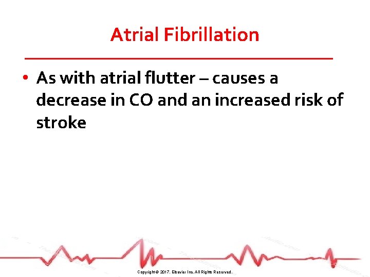 Atrial Fibrillation • As with atrial flutter – causes a decrease in CO and