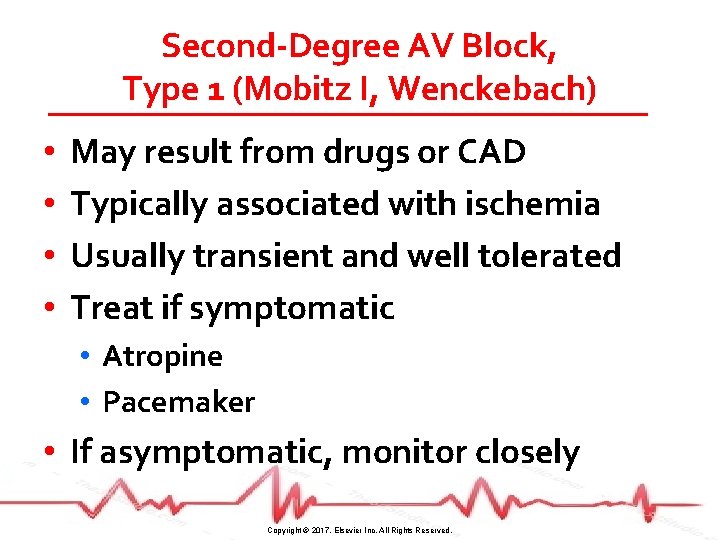 Second-Degree AV Block, Type 1 (Mobitz I, Wenckebach) • • May result from drugs