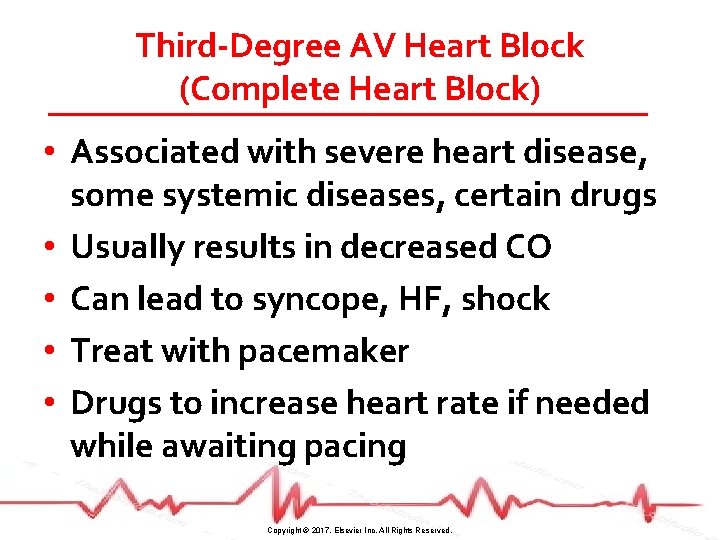 Third-Degree AV Heart Block (Complete Heart Block) • Associated with severe heart disease, some
