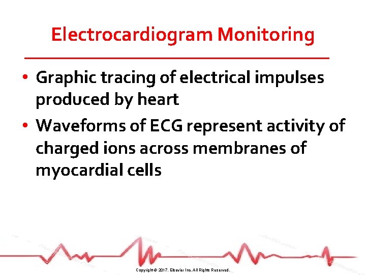 Electrocardiogram Monitoring • Graphic tracing of electrical impulses produced by heart • Waveforms of