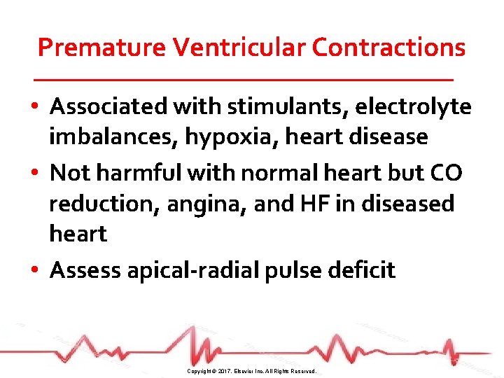 Premature Ventricular Contractions • Associated with stimulants, electrolyte imbalances, hypoxia, heart disease • Not
