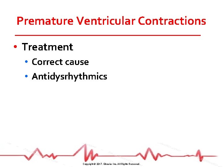 Premature Ventricular Contractions • Treatment • Correct cause • Antidysrhythmics Copyright © 2017, Elsevier