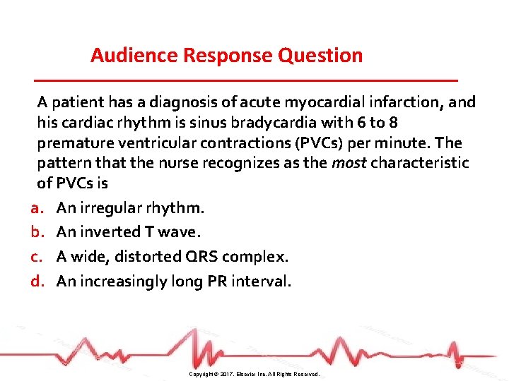 Audience Response Question A patient has a diagnosis of acute myocardial infarction, and his