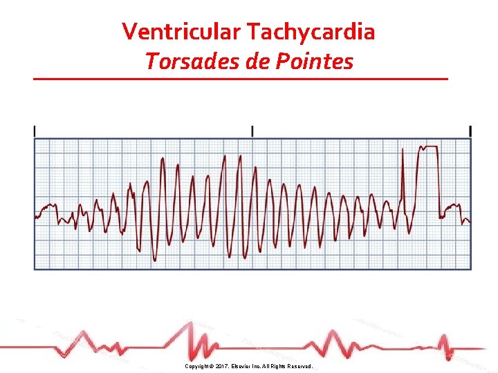 Ventricular Tachycardia Torsades de Pointes Copyright © 2017, Elsevier Inc. All Rights Reserved. 