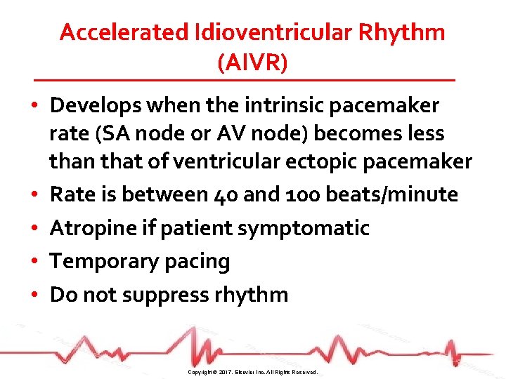 Accelerated Idioventricular Rhythm (AIVR) • Develops when the intrinsic pacemaker rate (SA node or