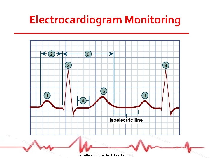 Electrocardiogram Monitoring Copyright © 2017, Elsevier Inc. All Rights Reserved. 