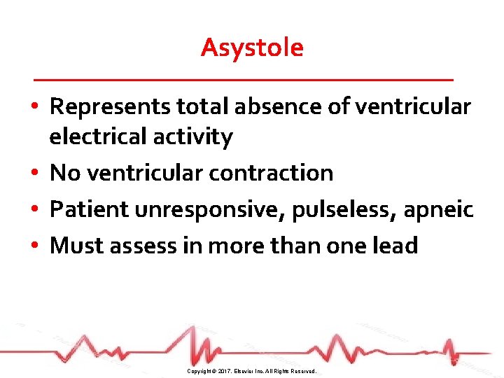 Asystole • Represents total absence of ventricular electrical activity • No ventricular contraction •