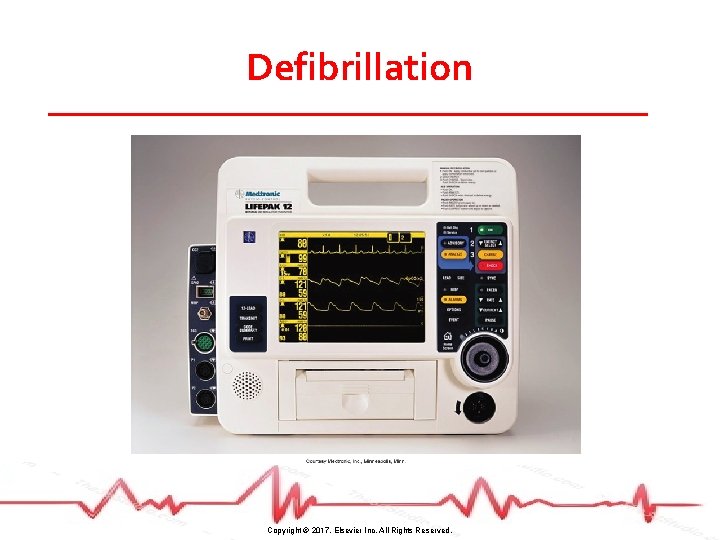 Defibrillation Copyright © 2017, Elsevier Inc. All Rights Reserved. 
