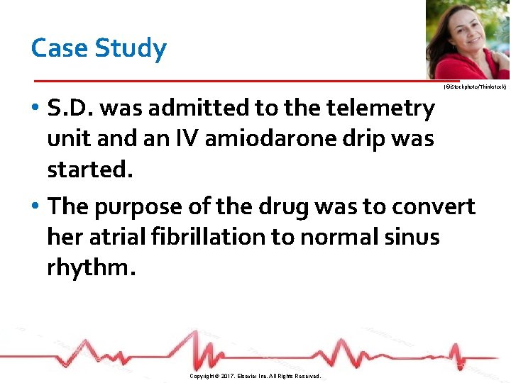 Case Study (©i. Stockphoto/Thinkstock) • S. D. was admitted to the telemetry unit and
