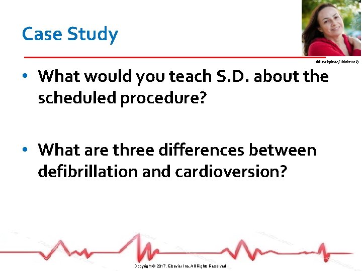 Case Study (©i. Stockphoto/Thinkstock) • What would you teach S. D. about the scheduled