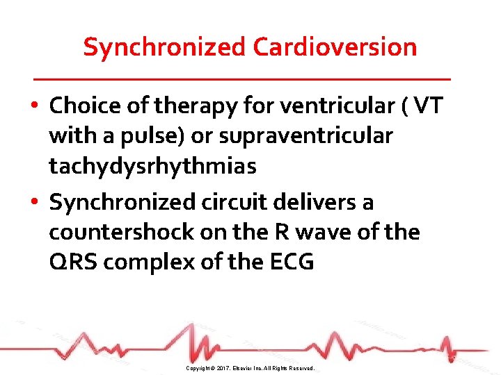 Synchronized Cardioversion • Choice of therapy for ventricular ( VT with a pulse) or