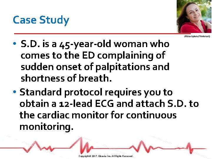 Case Study (©i. Stockphoto/Thinkstock) • S. D. is a 45 -year-old woman who comes