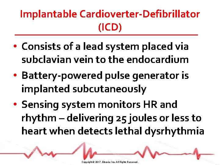 Implantable Cardioverter-Defibrillator (ICD) • Consists of a lead system placed via subclavian vein to