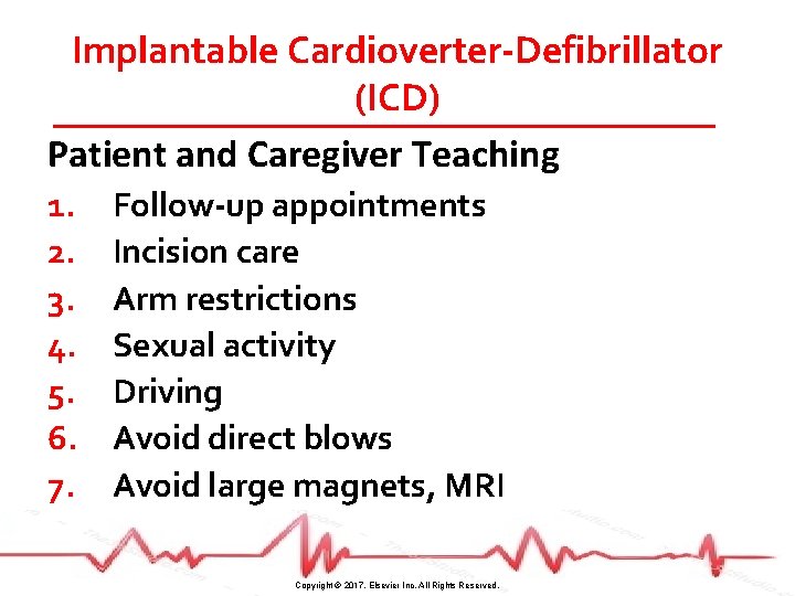 Implantable Cardioverter-Defibrillator (ICD) Patient and Caregiver Teaching 1. 2. 3. 4. 5. 6. 7.