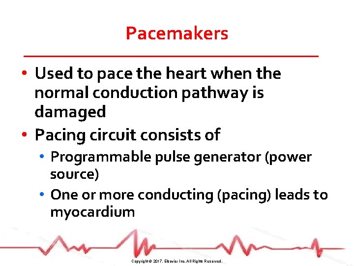 Pacemakers • Used to pace the heart when the normal conduction pathway is damaged