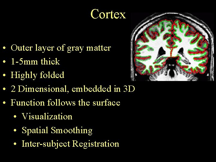 Cortex • • • Outer layer of gray matter 1 -5 mm thick Highly